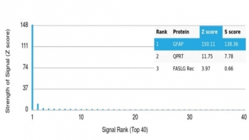 GFAP Antibody / Glial Fibrillary Acidic Protein