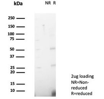 NME2 Antibody / Nucleoside diphosphate kinase B / NDKB