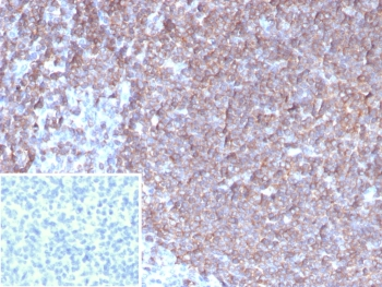 CSF3 Antibody / Granulocyte-Colony Stimulating Factor