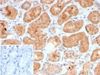 CSF3 Antibody / Granulocyte-Colony Stimulating Factor