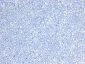 HER2 Antibody / ErbB2 / Extracellular region