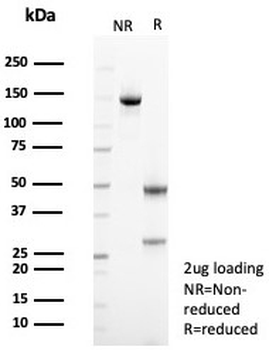 Mesothelin Antibody / MSLN
