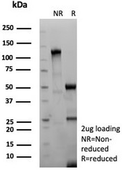 Glycoprotein 2 Antibody / GP2 / ZAP75