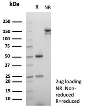 NUTM1 Antibody / NUT family member 1