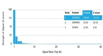 Alpha 1 Antitrypsin Antibody / AAT / SERPINA1