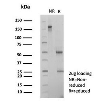 SNW1 Antibody / NCoA-62 / SKIP