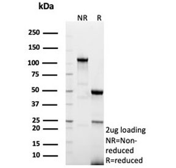 CD91 Antibody / LRP1 / A2MR