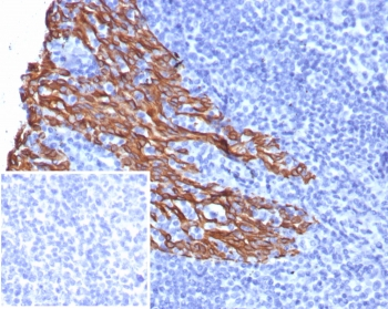 Cytokeratin 5 Antibody / KRT5