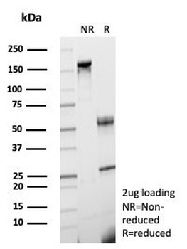FGF-23 Antibody / Fibroblast Growth Factor 23