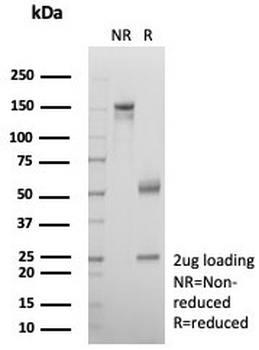 A2M Antibody / Alpha-2-Macroglobulin