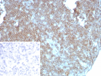 CD27 Antibody