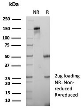 CXCR5 Antibody / BLR1 / MDR15