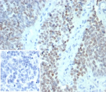 WT1 Antibody / Wilms Tumor 1