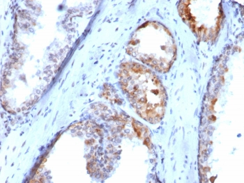 VMAT2 Antibody / SLC18A2