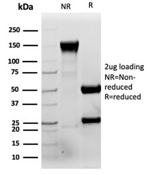 Retinol Binding Protein 4 Antibody / RBP4