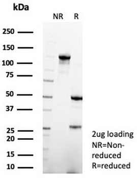 Surfactant protein D Antibody / SFTPD