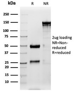 Surfactant protein D Antibody / SFTPD