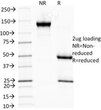 HSP27 Antibody / HSPB1