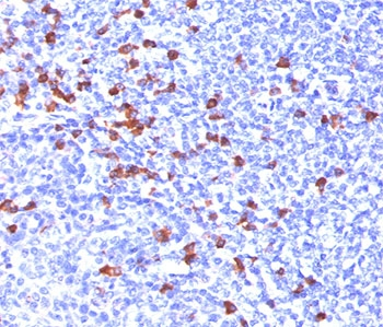 IgG Antibody