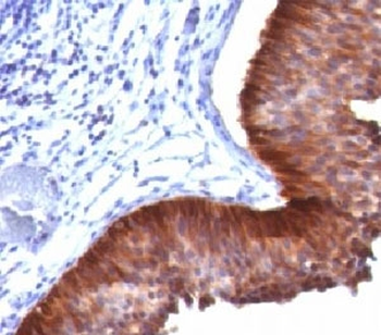 Cytokeratin 17 Antibody