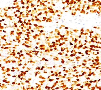 Myogenin Antibody / MYOG