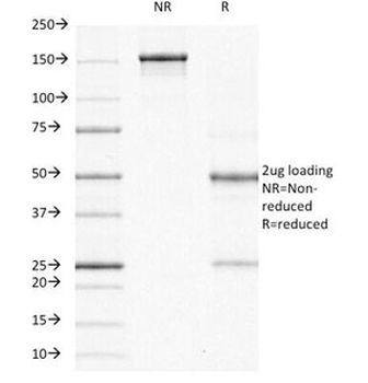 Ornithine Decarboxylase Antibody / ODC1