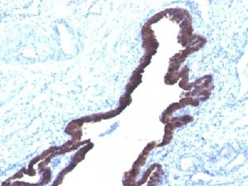 Cytokeratin 8/18 Antibody Cocktail