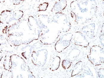 Basic Cytokeratin Antibody (HMW / Type II)
