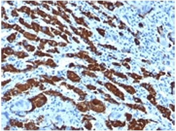 Hepatocyte Specific Antigen Antibody