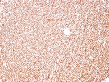 Nucleoli Marker Antibody