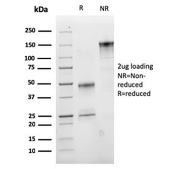 VLDLR Antibody / VLDL Receptor