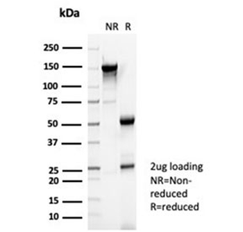 Reelin Antibody / RELN