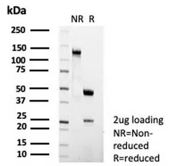 Recombinant FCER2 Antibody / CD23