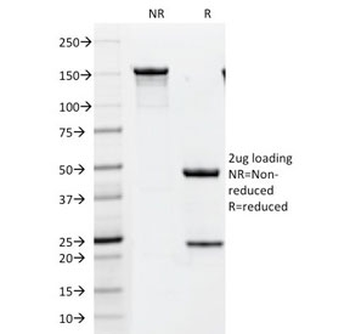 HER2 Antibody / ErbB2