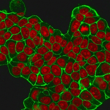 HER2 Antibody / ErbB2