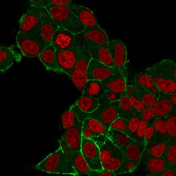 HER2 Antibody / ErbB2