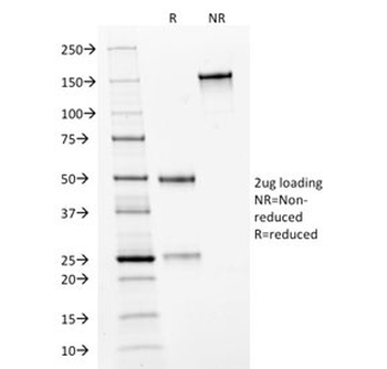 HER2 Antibody / ErbB2