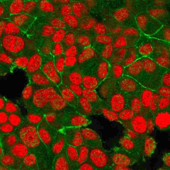 HER2 Antibody / ErbB2