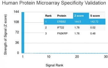 HER2 Antibody / ErbB2