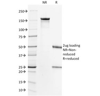 HER2 Antibody / ErbB2