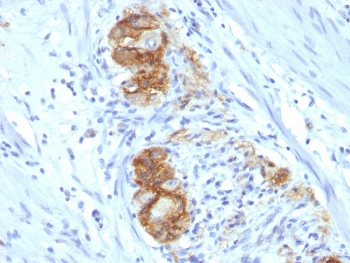 NCAM / CD56 Antibody