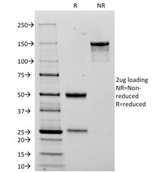 NCAM / CD56 Antibody