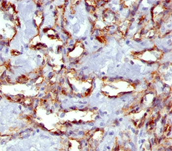 CD31 Antibody / PECAM-1