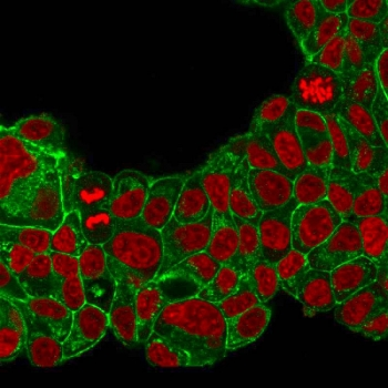 HER2 Antibody / ErbB2