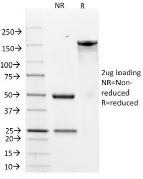 HER2 Antibody / ErbB2