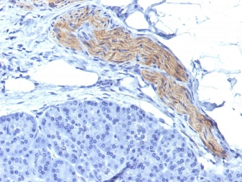 NCAM / CD56 Antibody