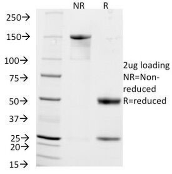 NCAM / CD56 Antibody