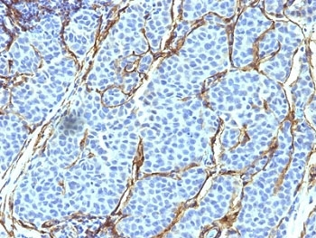 NGF Receptor Antibody / p75NTR / CD271