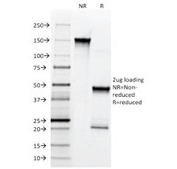 NGF Receptor Antibody / p75NTR / CD271