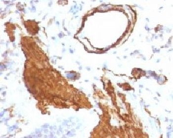 Alpha Smooth Muscle Actin Antibody